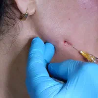 آموزش خدمات  پوست ،مو وزیبایی|خدمات آموزشی|تبریز, |دیوار