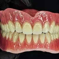 دندانسازی اقساط