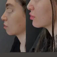 فیلر بوتاکس ژل لب لیزر لاغری تمامی خدمات توسط پزشک