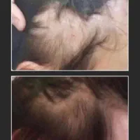 راز ریش و موی پر پشت اینجاست