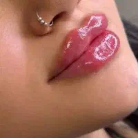 ژل بوتاکس مزو انزیم .پرسینگ .لیفت نخ .چال لپ|خدمات آرایشگری و زیبایی|شاهینشهر, شهرک پردیس|دیوار