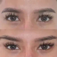 آفر ویژه خدمات زیبایی ژل فیلر بوتاکس لیفت|خدمات آرایشگری و زیبایی|شاهینشهر, طالقانی|دیوار