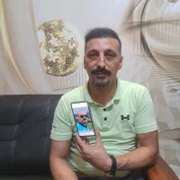 کلینک تخصصی کاشت مو تبریز|خدمات آرایشگری و زیبایی|اردبیل, |دیوار