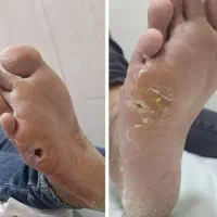 بهبودودرمان قندخون بصورت گیاهی|آرایشی، بهداشتی، درمانی|اهواز, شریعتی جنوبی|دیوار