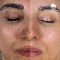 فیشال تخصصی به همراه ویال های جوانسازفقط ۵۹۰