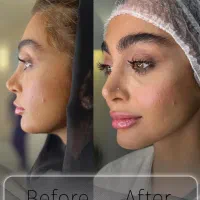 جوانسازی و لیفت بدون جراحی|خدمات آرایشگری و زیبایی|تهران, اختیاریه|دیوار