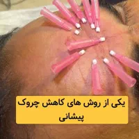 خدمات تخصصی پوست و مو در کلینیک فرسیما|خدمات آرایشگری و زیبایی|اسلامشهر, باغ فیض|دیوار