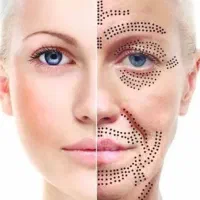 پلاسما الکترولیزموهای زاعدصورت وتتوبدن فقط 699تومن