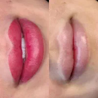خدمات شیدینگ لب|خدمات زیبایی و سلامت|اهواز, رسالت|دیوار