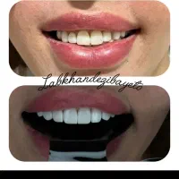 دندانپزشکی لبخند زیبای تو با ۳۰ درصد تخفیف