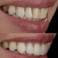 درمانی و زیبایی جشنواره پاییزه
