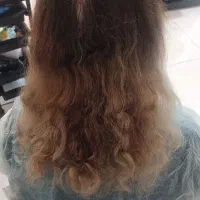 احیای مو
