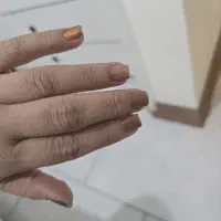 کاشت و تریم ناخن