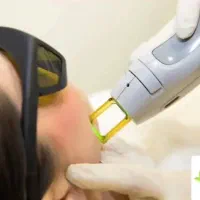 خدمات لیزر و زیبایی