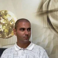 کاشت مو وابرو تبریز
