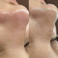 تخفیف آموزش و خدمات فیشال تخصصی بانوان و آقایان|خدمات آرایشگری و زیبایی|مشهد, کوثر|دیوار