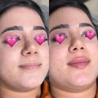 آفر بهاره خدمات زیبایی درکلینیک مهسان