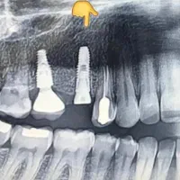 دندانپزشکی اقساطی بدون بهره|خدمات آرایشگری و زیبایی|کرج, کوی کارمندان شمالی|دیوار