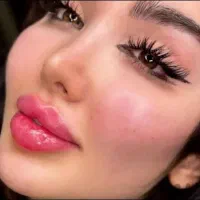 کلینیک جراحی نخ آنزیم غبغب مزو ژل فیلر بوتاکس|خدمات آرایشگری و زیبایی|کرج, گوهردشت|دیوار