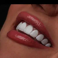 کامپوزیت لمینت دندانپزشکی عصب کشی