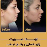 تناسب اندام