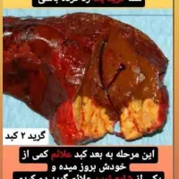 سفارش مینی پک گیاهیبرای پاکسازی کبد و لاغری شکم