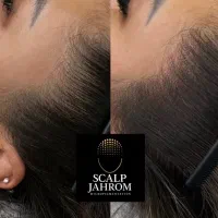 میکرواسکالپ سر|خدمات آرایشگری و زیبایی|جهرم, |دیوار