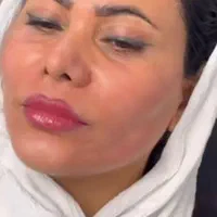 کرم لک سفید کننده فیلیپینی|آرایشی، بهداشتی، درمانی|بندرعباس, |دیوار