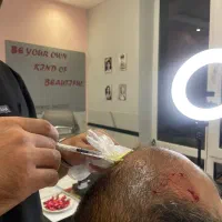 معجزه جوانسازی(پی آر پی)|خدمات آرایشگری و زیبایی|اردبیل, |دیوار