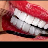 جشنواره پاییژه دندانپزشکی|خدمات آرایشگری و زیبایی|قم, چهار امامزاده|دیوار