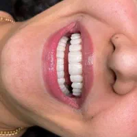اموزش کامپوزیت
