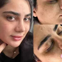 پلاژن تراپی پوست(پوست کره ای)