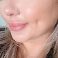 انجام خدمات پرسینگ چال لپ میکرودرمال|خدمات آرایشگری و زیبایی|قم, شهرک فاطمیه|دیوار