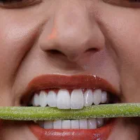 کامپوزیت/دندان پزشکی/لمینیت