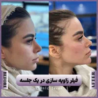 تخفیفات ۵۰% دکتر بوتاکس مزو فیلر ژل لب روسی|خدمات آرایشگری و زیبایی|مشهد, هنرستان|دیوار