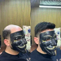 پروتزمو قم|خدمات آرایشگری و زیبایی|قم, زاد|دیوار