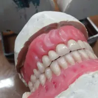 ساخت انواع دندان مصنوعی ژله‌ای آلمانی|خدمات آرایشگری و زیبایی|کرج, آزادگان|دیوار