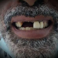 ساخت و تعمیر انواع پروتز های متحرک (دندان مصنوعی)|خدمات آرایشگری و زیبایی|دوگنبدان, |دیوار