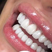 طرف قرارداد با بیمه ها/قیمت استثنایی/باکیفیت|خدمات آرایشگری و زیبایی|شیراز, ملاصدرا|دیوار