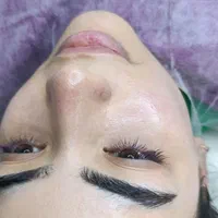 فیشال تخصصی پاکسازی۲۰۰تومان مزو کربوکسی اسیدتراپی|خدمات آرایشگری و زیبایی|مشهد, هدایت|دیوار