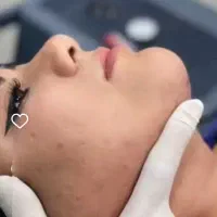 ۴۰٪آف۲۰روزه/غبغب/سوپرکانتور/بادستگاه۲۰۲۵پال آمریکا
