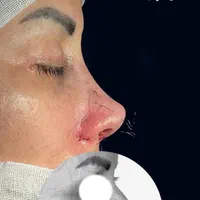 عمل جراحی بینی /لیفت صورت/پلک|خدمات آرایشگری و زیبایی|کرج, عظیمیه|دیوار