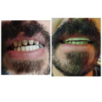 اورژانس دندانپزشکی در منزل شما شبانه‌روزی|خدمات آرایشگری و زیبایی|کرج, فاز ۱ مهرشهر|دیوار