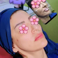 ۲۰ درصد تخفیف خدمات ژل و بوتاکس|خدمات آرایشگری و زیبایی|دوگنبدان, |دیوار