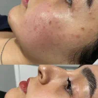 پاکسازی و فیشیال تخصصی