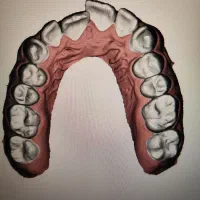ارتودنسی شفاف دیجیتال|خدمات زیبایی و سلامت|تهران, آسمان|دیوار