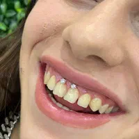 آموزش و خدمات پیرسینگ میکرودرمال چال لپ مدل|خدمات آرایشگری و زیبایی|لاهیجان, شیشه گران|دیوار