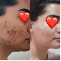 محصولات پوست و مو در ملاثانی