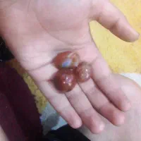 مهره سلیمانی