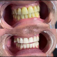 آموزش تخصصی دندانسازی و بلیچینگ و کامپوزیت|خدمات آموزشی|شیراز, معالیآباد|دیوار